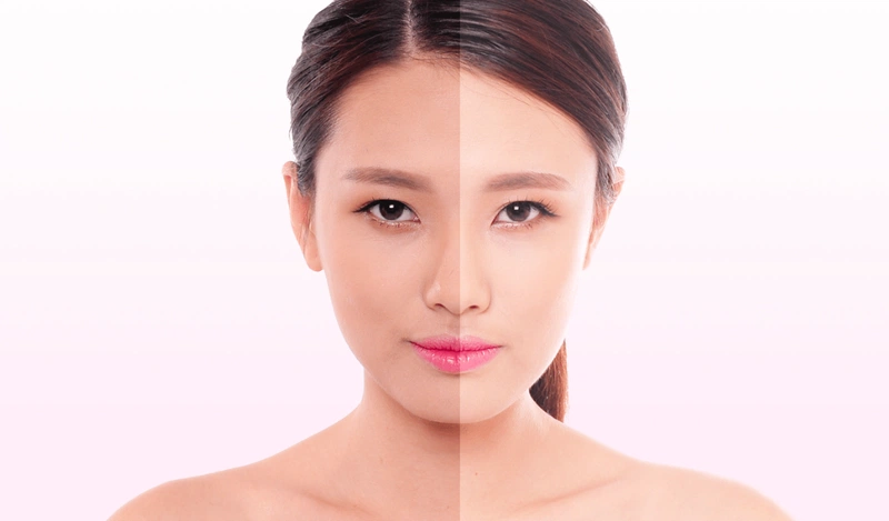 nguyên nhân dẫn đến da mặt đen là do chăm sóc da không đúng cách