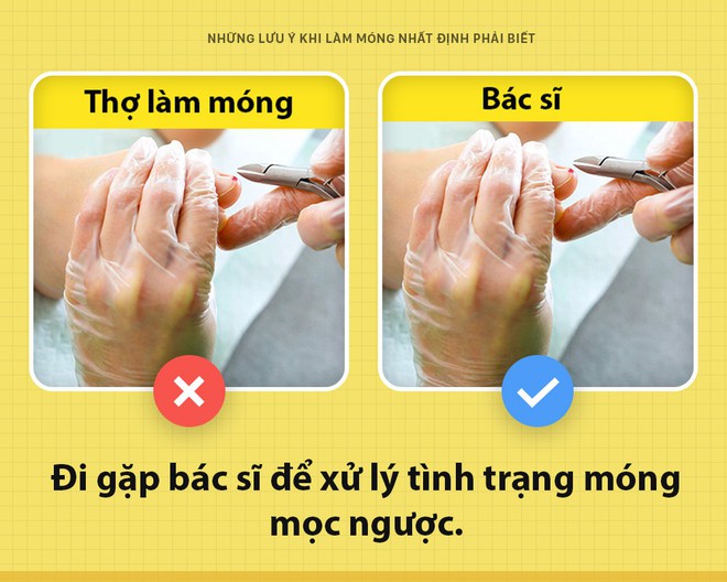 Top 7 điều nên biết khi làm nail bạn cần lưu ý